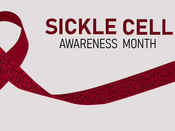 Unraveling the Mysteries of Sickle Cell Disease: Beyond the Crescent-Shaped Cells